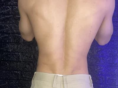 laurent_nova