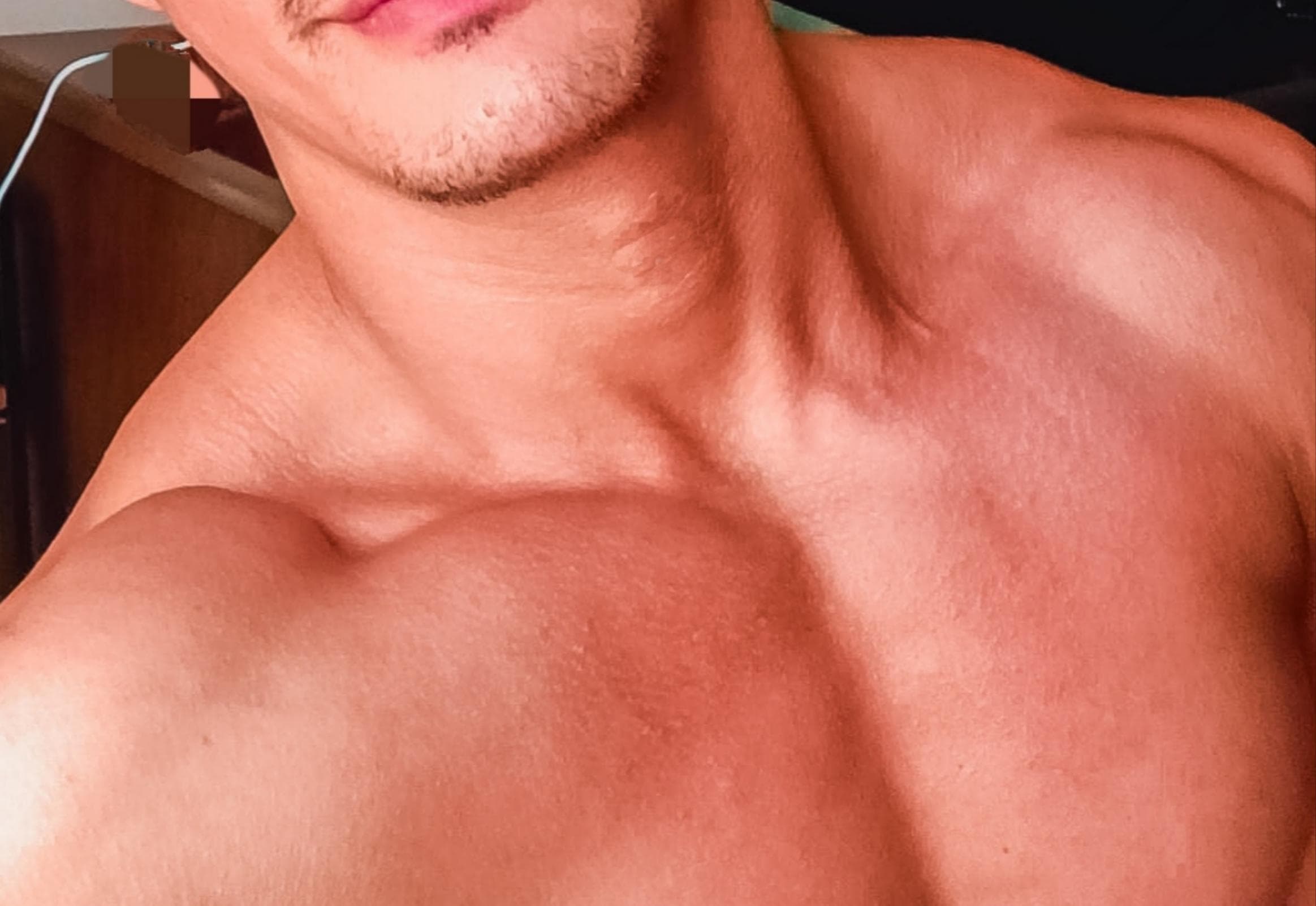 muscleoss